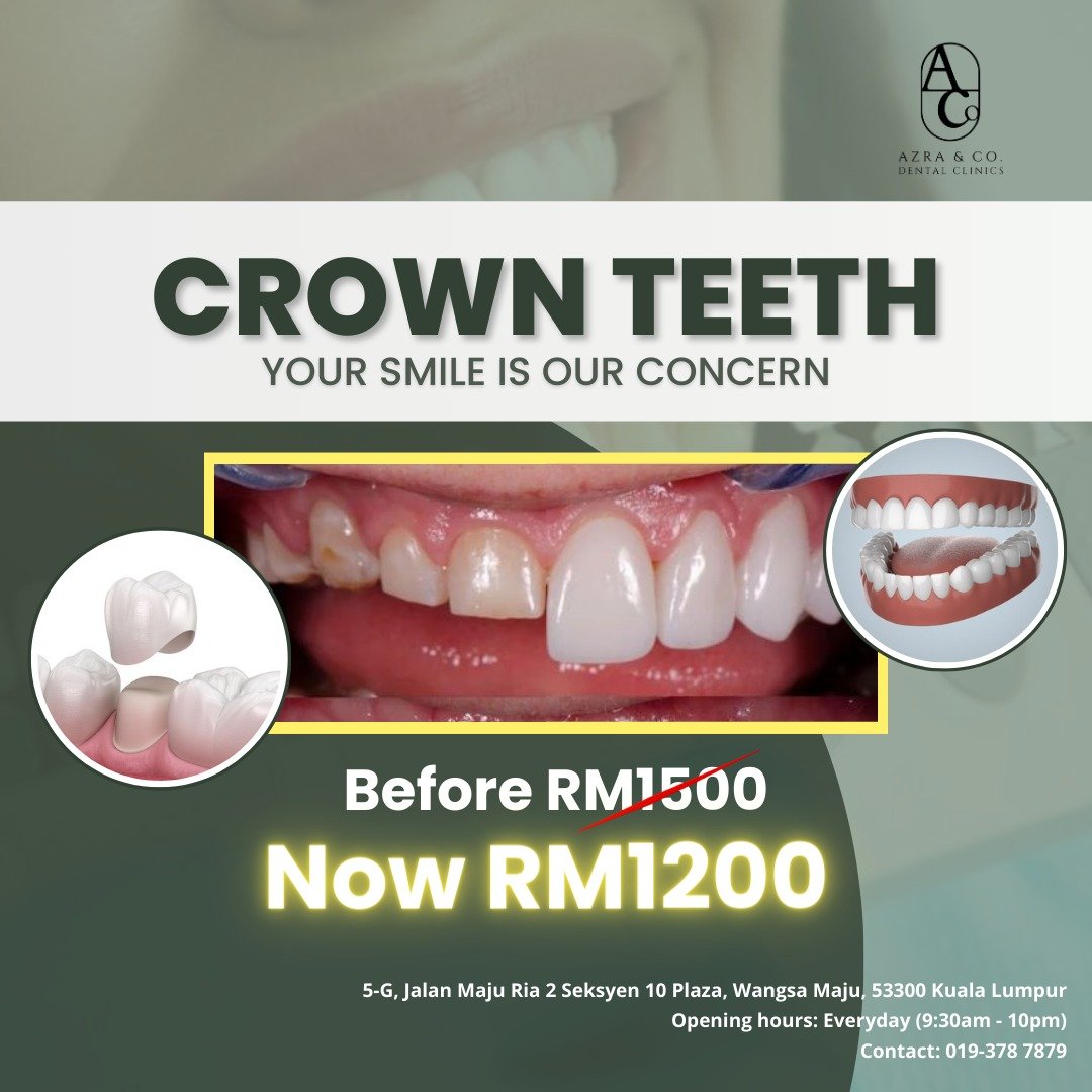 Crown Teeth Azra Cleaning