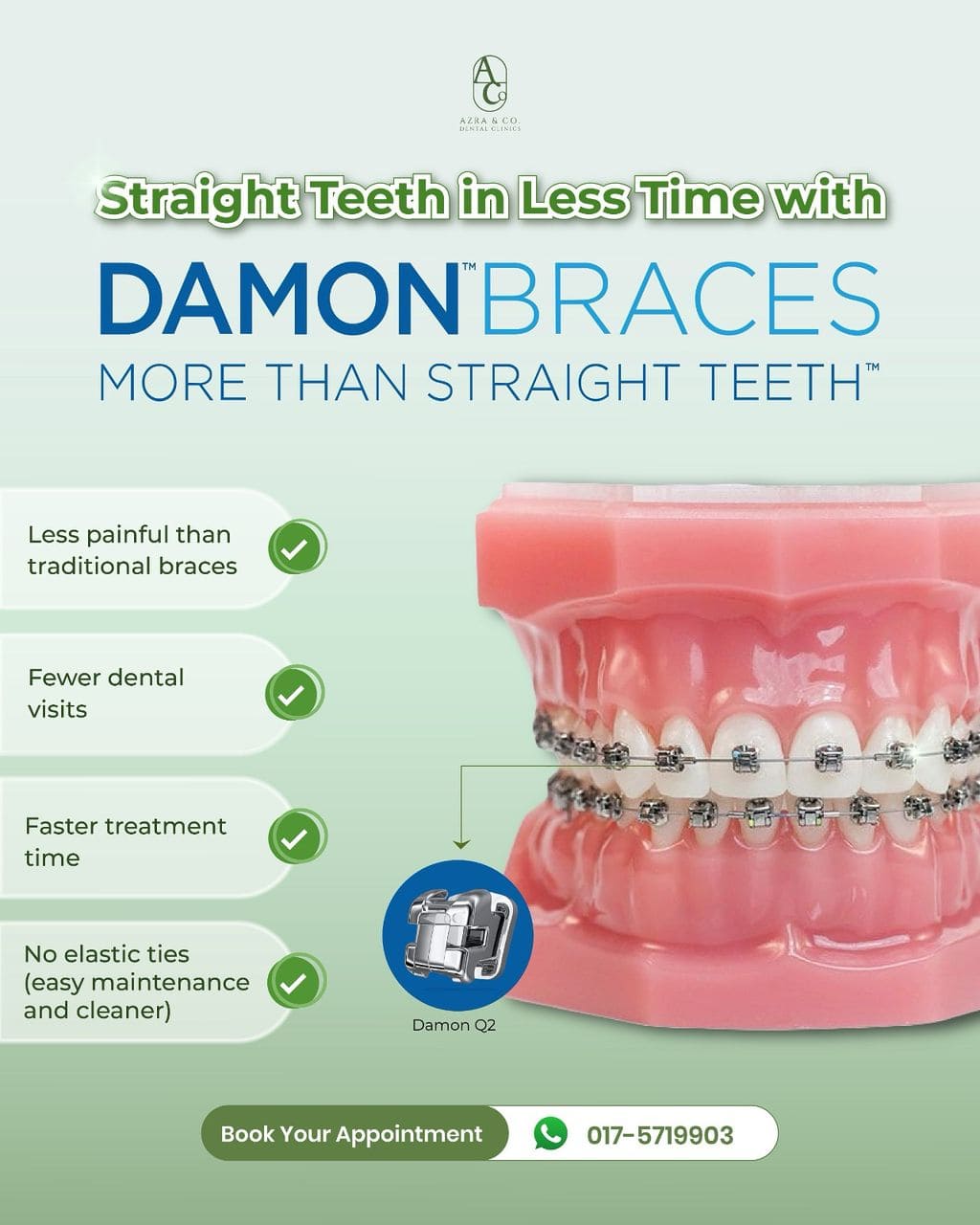 Damon Braces